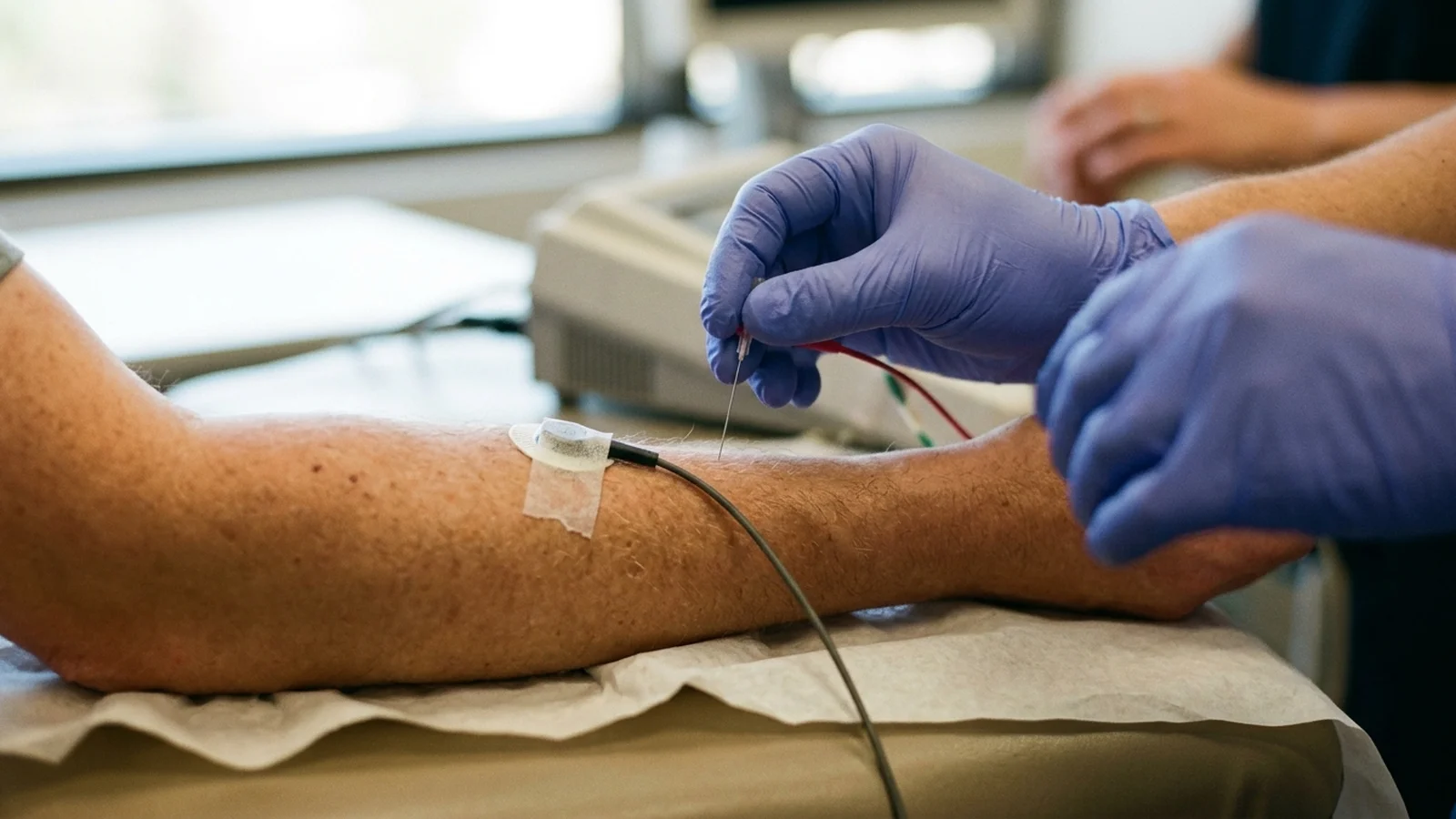 CPT 95860: Needle EMG, One Extremity